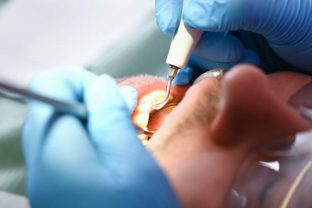 Best Emergency Dental Care for Broken or Chipped Teeth in Suisun City, CA